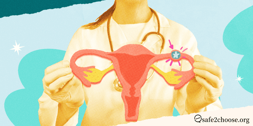 A healthcare provider holding a diagram of the female reproductive system, highlighting the fallopian tube to indicate an ectopic pregnancy